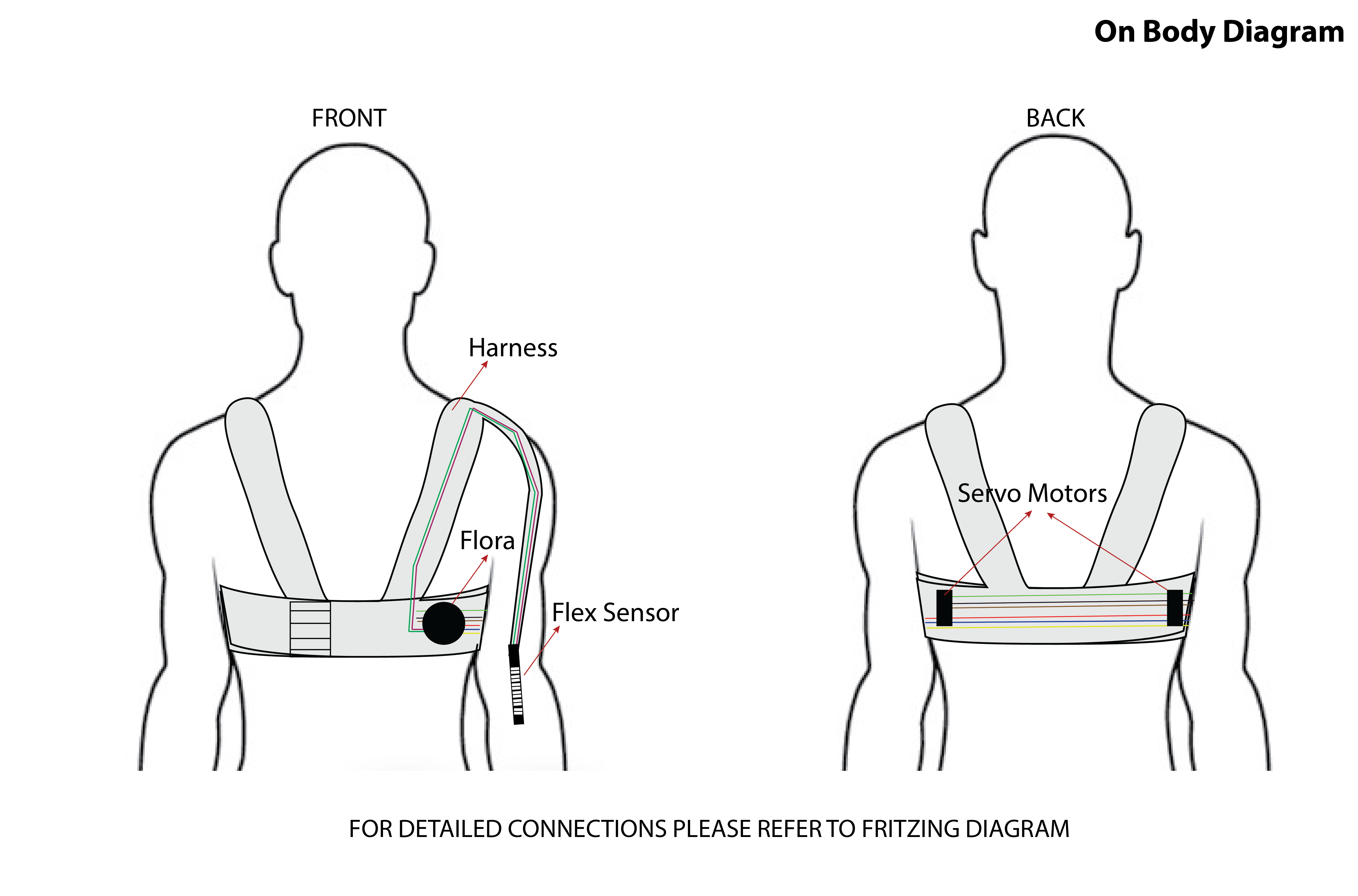 On Body Diagram